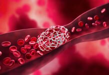 AI recruited to lower leading cause of preventable hospital deaths