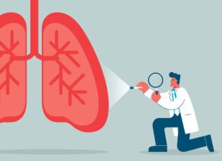 Bespoke ctDNA Test Detects MRD in Lung Cancer Patients Years Before Imaging