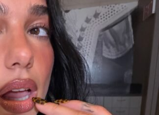 Celebs Are Obsessed With Animal-Print Nails—5 Takes That Will Dominate This Winter