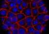 As oncologists ponder how to integrate AI-powered cancer tools, products are hitting the market