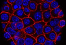 As oncologists ponder how to integrate AI-powered cancer tools, products are hitting the market