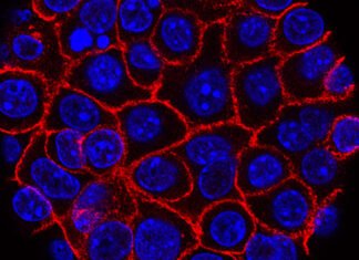 As oncologists ponder how to integrate AI-powered cancer tools, products are hitting the market