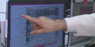 Cleveland Clinic teaching artificial intelligence to read brain waves and detect seizures in seconds