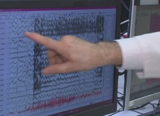Cleveland Clinic teaching artificial intelligence to read brain waves and detect seizures in seconds