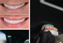 Crafting Smiles as Art: An Interview with Bespoke Smile’s Founder on Aesthetics, Design and Dental Luxury