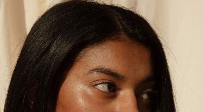 If You’re Going to Splurge on One Skincare Treatment in 2026, Please Let It Be the “Red Carpet Laser”
