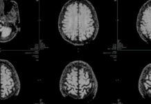 Healthcare Is AI’s Hardest Test