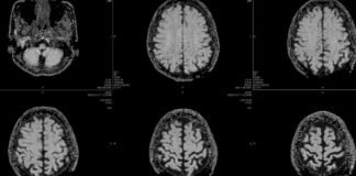 Healthcare Is AI’s Hardest Test