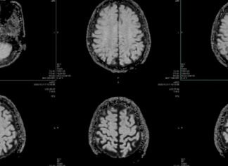 Healthcare Is AI’s Hardest Test