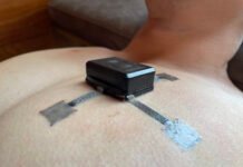 Paint-on Electrodes Enable Bespoke Health Monitoring
