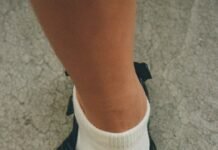 The Barely-There Hiking Sandal Is the Official Shoe of the Summer