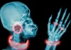 Jewellery made of carcinogen sold as silver on Amazon and TikTok