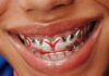 Futuristic Flair: Loud Mouth LDN Transforms Nissan Car Grilles into Daring Grillz Collection