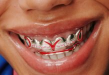 Futuristic Flair: Loud Mouth LDN Transforms Nissan Car Grilles into Daring Grillz Collection