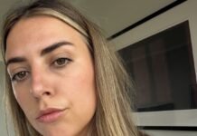 I Hate Wearing Foundation—This Is the Brightening Concealer Alternative I Refuse to Be Without